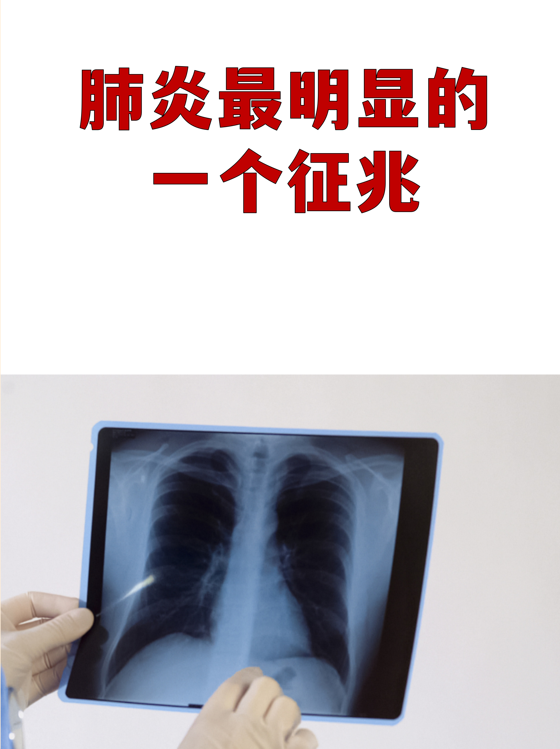 “武汉新增4例本土确诊病例” 武汉新增肺炎？-第1张图片