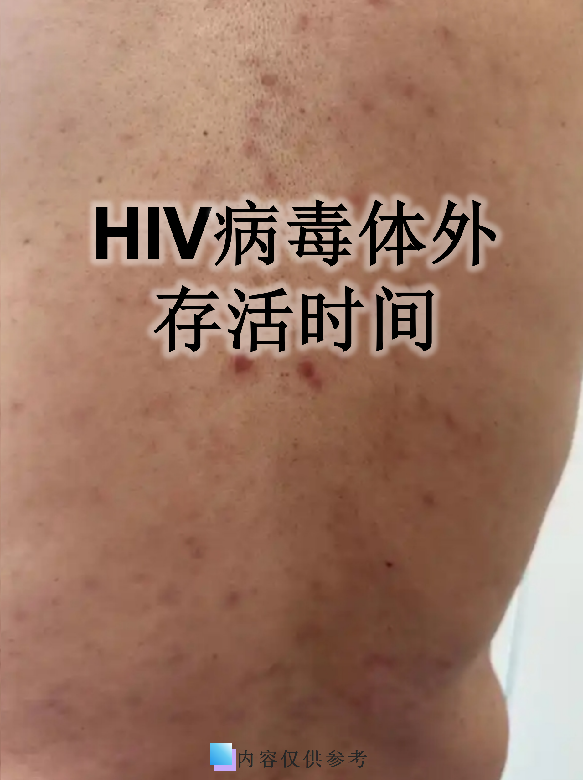 “江苏新增无症状感染者13例” 江苏新增无症状感染者13例？-第2张图片