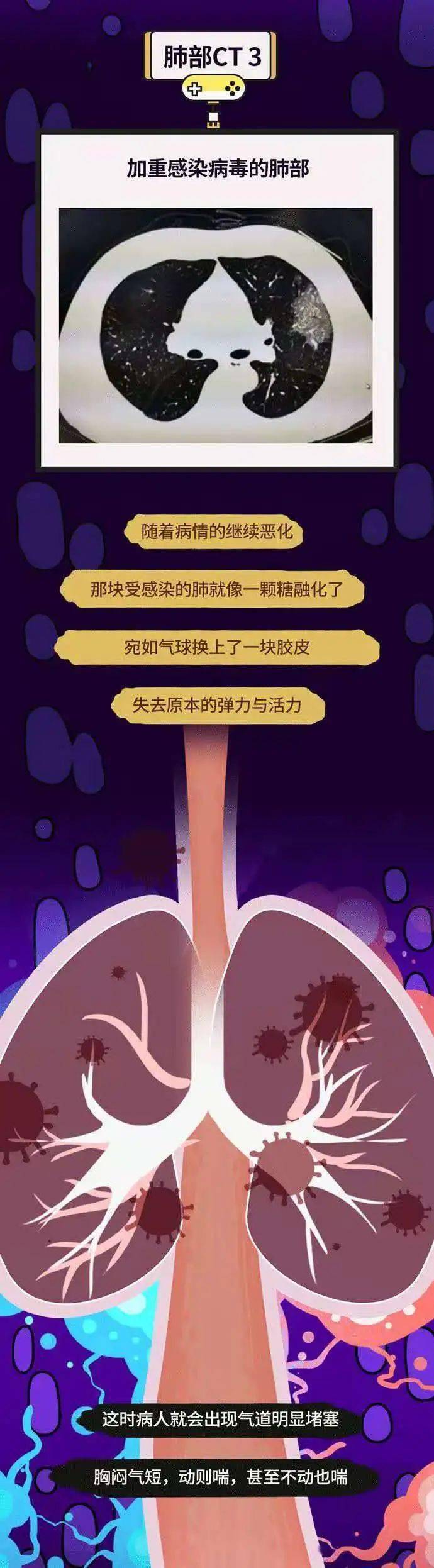 “上海新冠	” 上海新冠病毒感染最新情况？-第1张图片